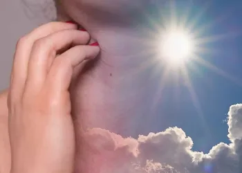 Güneş alerjiyi arttırıyor