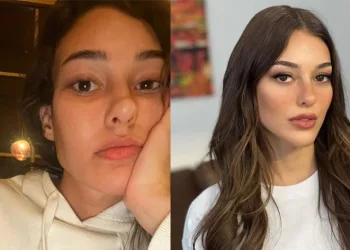 Dilan Çiçek Deniz’den makyajsız poz