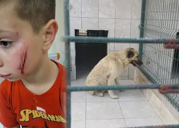 Bursa’da köpeğin saldırdığı çocuk yaralandı
