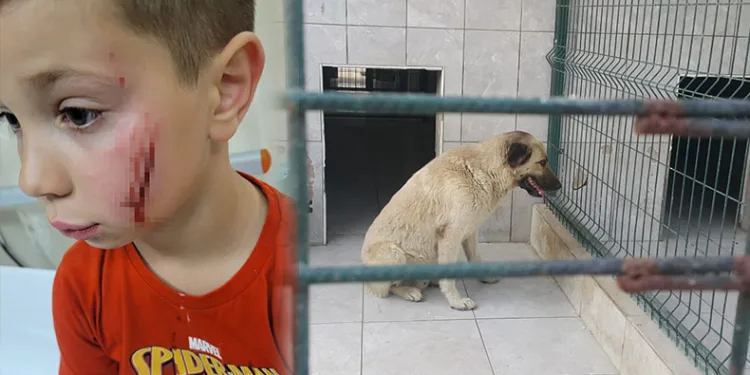 Bursa’da köpeğin saldırdığı çocuk yaralandı
