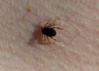 Kene vakaları yükselişte