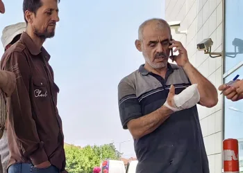 Dalgınlık sonucu sağ elini kesim motoruna kaptırdı