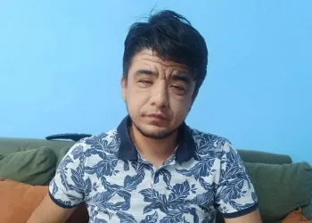 Enes’in nadir görülen hastalığı
