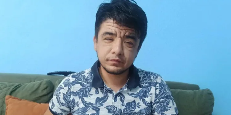 Enes’in nadir görülen hastalığı