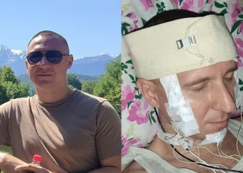 Rüyalarının kontrolü için kafasını deldi