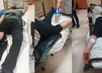 Sokak köpeklerinin saldırdığı kişiler hastanelik oldu