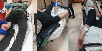 Sokak köpeklerinin saldırdığı kişiler hastanelik oldu
