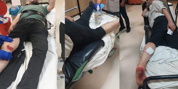 Sokak köpeklerinin saldırdığı kişiler hastanelik oldu