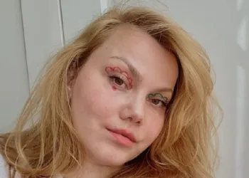 Kocası tarafından bıçaklanan Youtuber hastanede