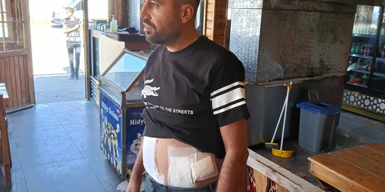 Tepki gösterince karnından bıçaklandı
