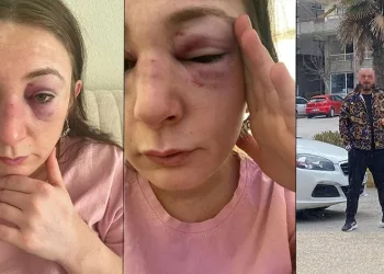 Bursa’da kadına şiddet, eski erkek arkadaşı darp etti
