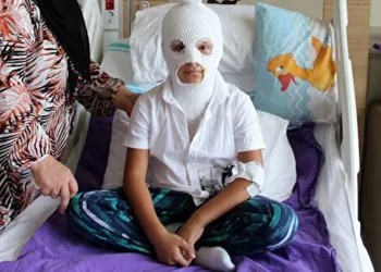 Hastaneler, kolonyaya çakmak tutan çocuklarla doldu