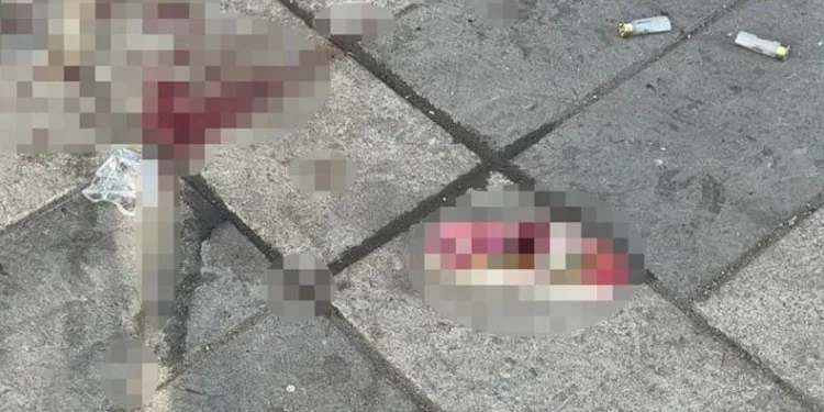 Maganda kurşunu 7 aylık bebeği canından etti