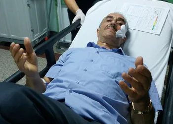 Nişan töreninde maganda kurşunuyla yüzünden vuruldu