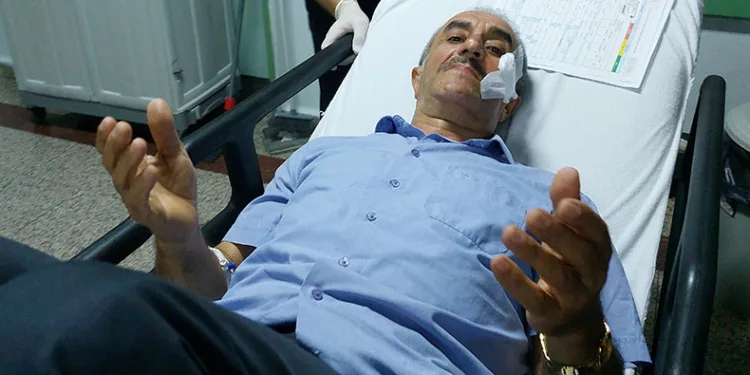 Nişan töreninde maganda kurşunuyla yüzünden vuruldu