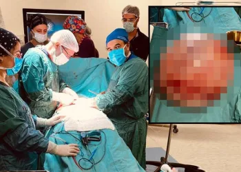 Hamile olduğunu sanıyordu,15 kilo kist çıktı