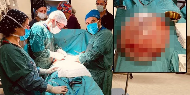 Hamile olduğunu sanıyordu,15 kilo kist çıktı