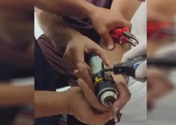 Matkaba sıkışan parmağını itfaiye çıkarttı