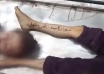 Saldırılarda hayatını kaybeden çocukların kimlikleri kollarına yazılıyor