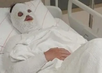 Eski nişanlısına kimyasal sıvı attı