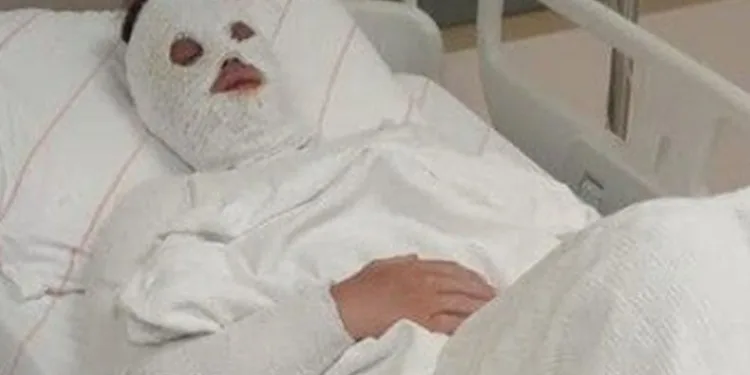 Eski nişanlısına kimyasal sıvı attı