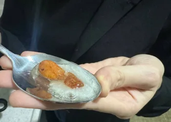 Kek yapmak isterken şoke oldu