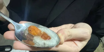 Kek yapmak isterken şoke oldu