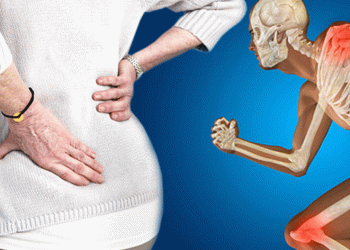 “Osteoporoz hastalığı kemikleri çalıyor”