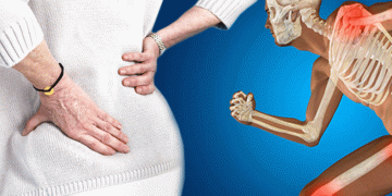 “Osteoporoz hastalığı kemikleri çalıyor”