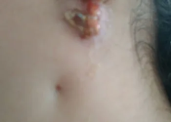 Ailesi kızlarının hastalığına çare arıyor