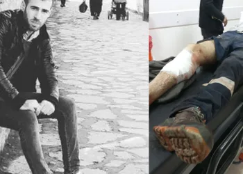 Oltu’da çobana domuz saldırdı