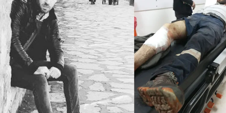 Oltu’da çobana domuz saldırdı