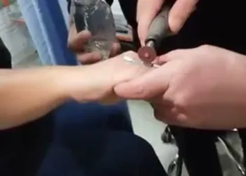 Parmağa sıkışan yüzüğü itfaiye çıkardı