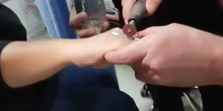 Parmağa sıkışan yüzüğü itfaiye çıkardı