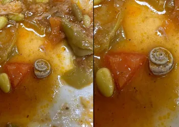 Hastane yemeğinde ‘salyangoz’ çıktı