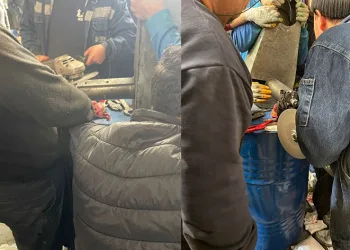 Kolunu pres makinesine kaptırdı