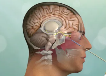 Hipofiz adenomları görme kaybı oluşturabilir