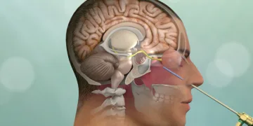 Hipofiz adenomları görme kaybı oluşturabilir