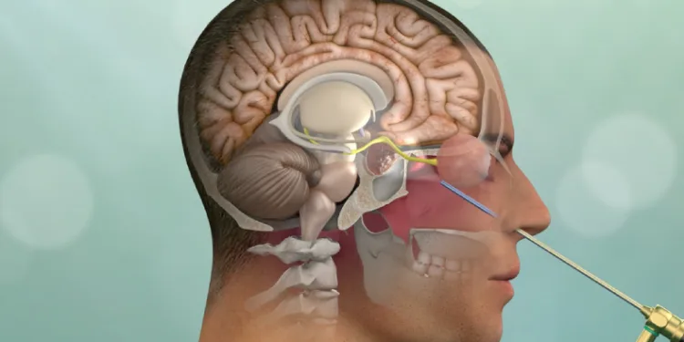 Hipofiz adenomları görme kaybı oluşturabilir
