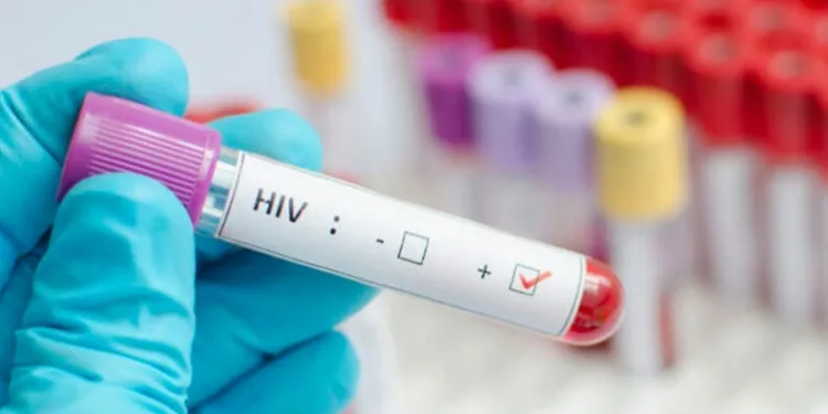 1 Aralık Dünya AIDS Günü