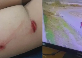 Ankara’da bisiklet süren çocuğa köpek saldırdı