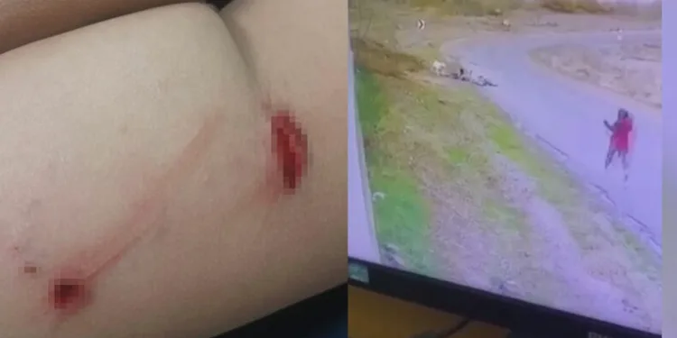 Ankara’da bisiklet süren çocuğa köpek saldırdı