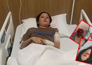 12 yaşındaki çocuk sokak köpeğinin saldırısına uğradı
