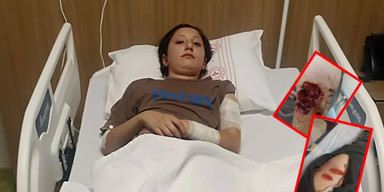 12 yaşındaki çocuk sokak köpeğinin saldırısına uğradı
