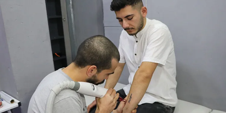 Ayrılan sevgililerin dövme sildirme telaşı
