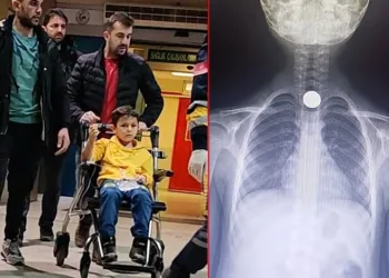 Bursa’da 7 yaşındaki çocuk madeni para yuttu