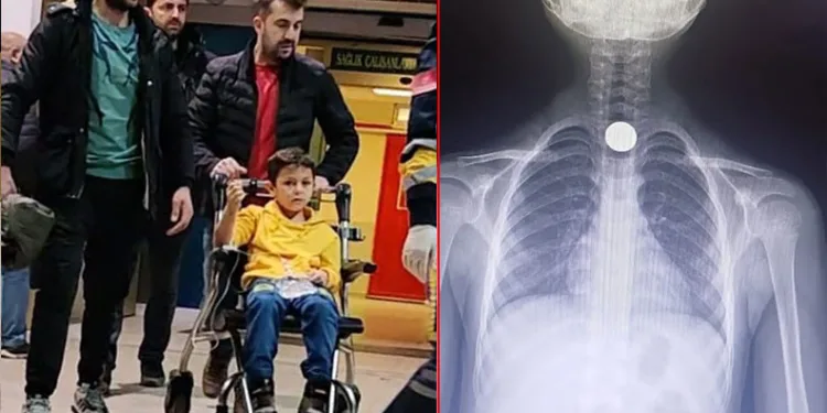 Bursa’da 7 yaşındaki çocuk madeni para yuttu
