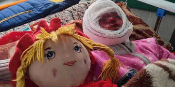 İsrail’in saldırılarında yüzü yanan 4 yaşındaki Seca, tedavi için bekliyor