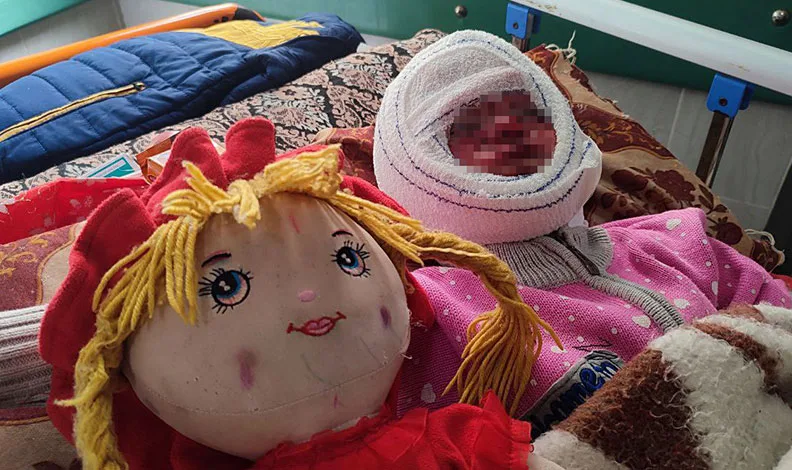 İsrail’in saldırılarında yüzü yanan 4 yaşındaki Seca, tedavi için bekliyor