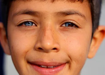 Hayata çift renk bakıyor